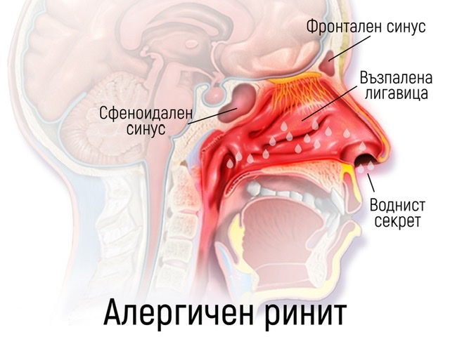 Видеонистагмография